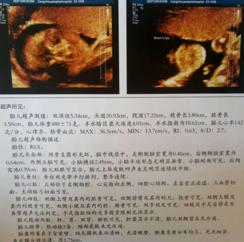 广州代怀孕代孕多少钱|2023黄冈三代试管婴儿生混血宝宝全部费用，单周期价格