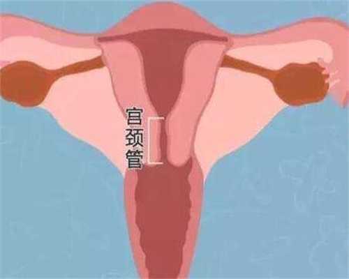广州最好的代孕,做试管婴